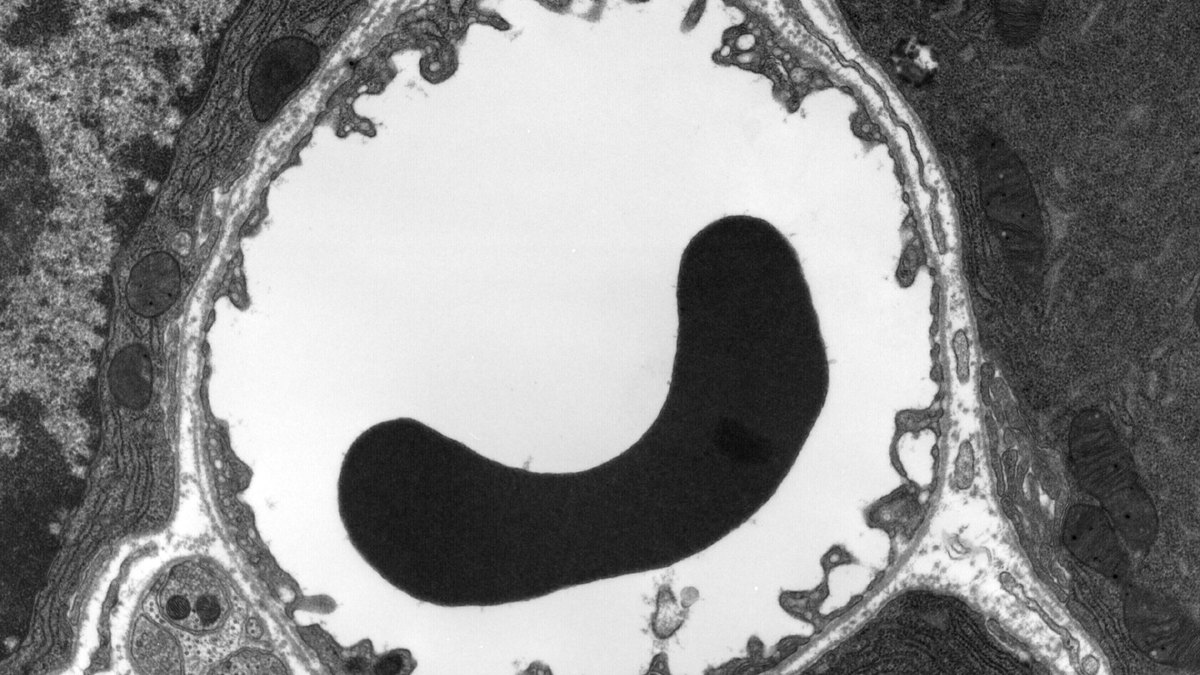 Electron micrograph of a capillary cross-section — the endothelium and its thin basement membrane wrapping the vessel; a Bodenkor feature by Panacea Bio Chem and Bogdan Dicoias